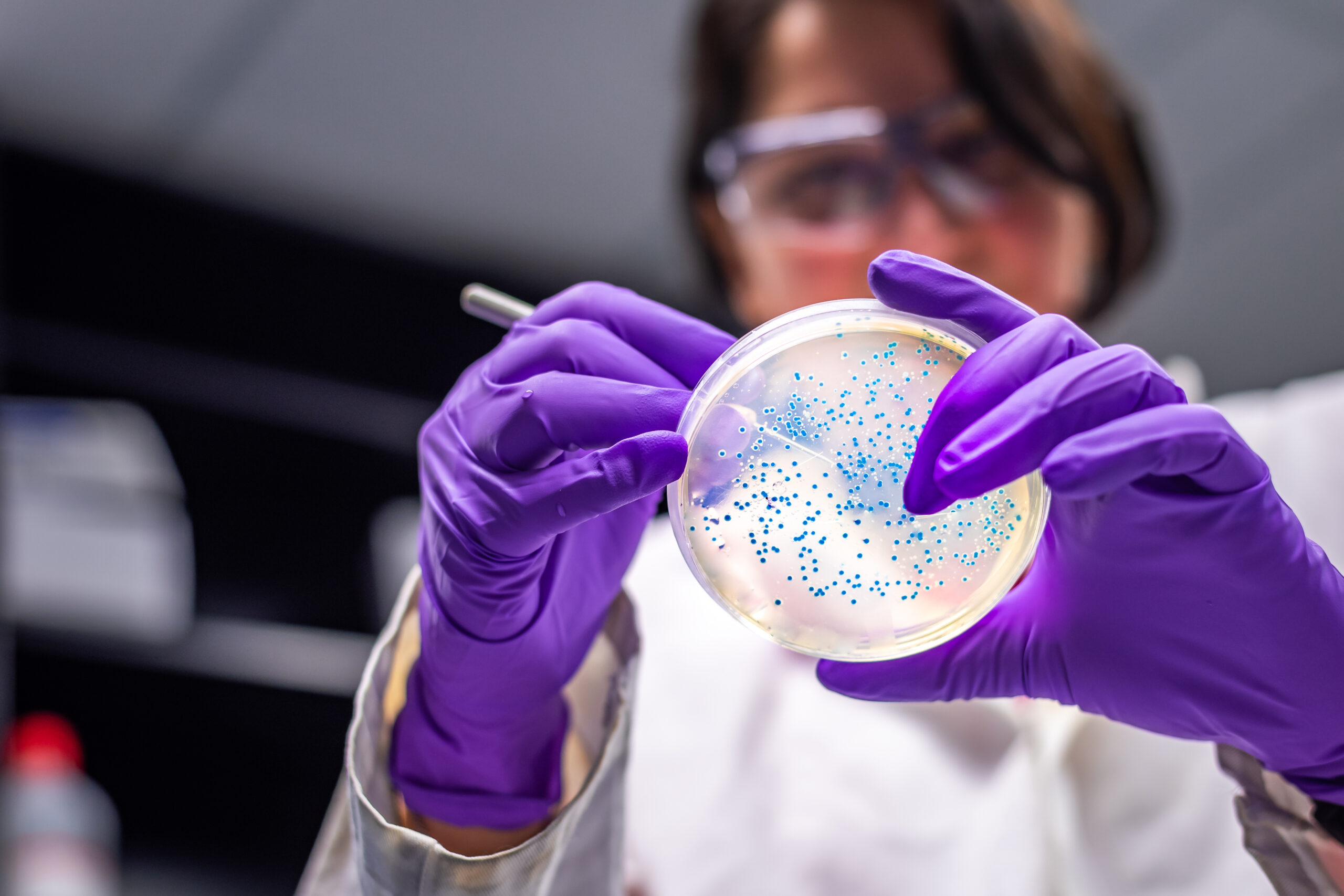 e-coli bacteria