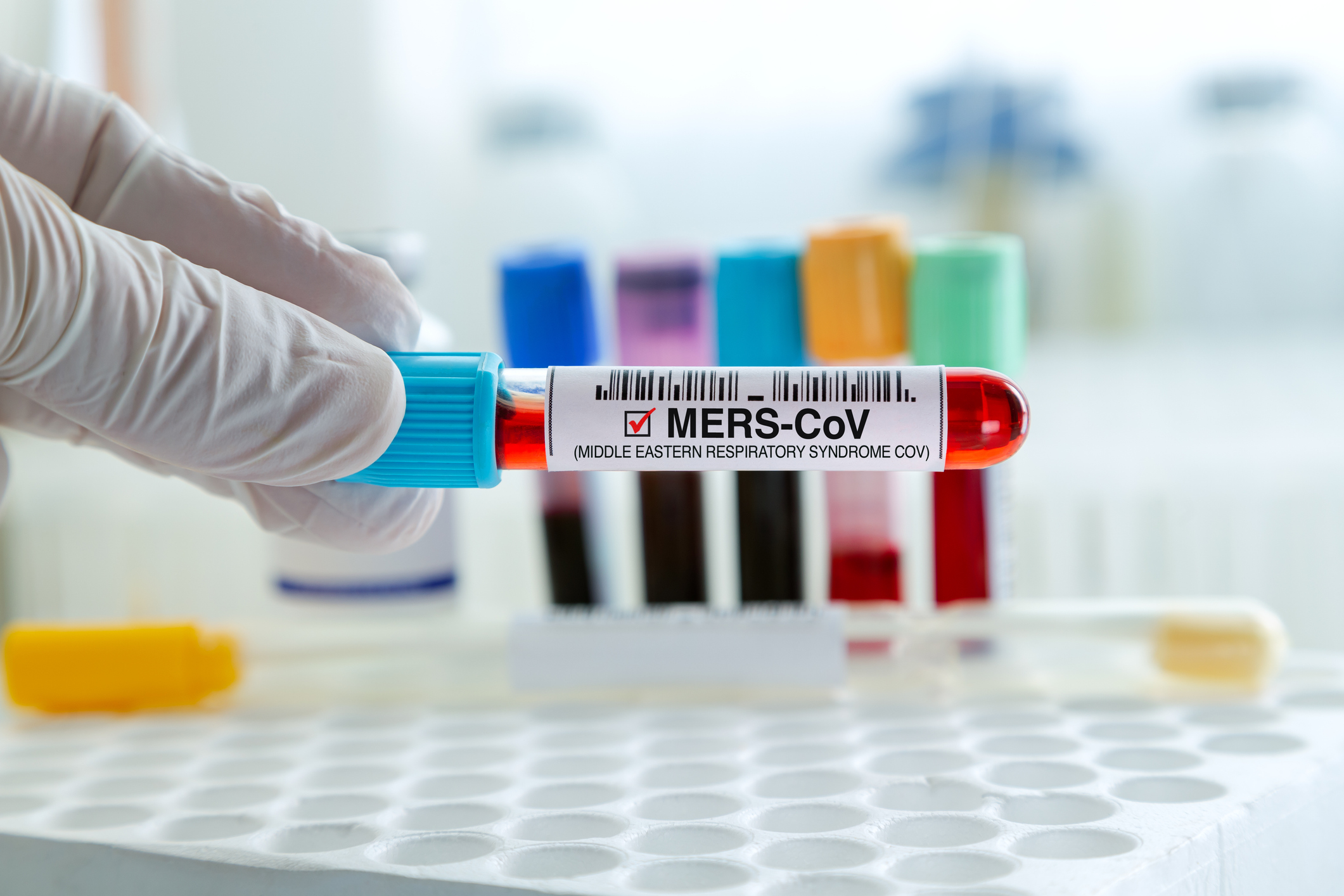 MERS-CoV